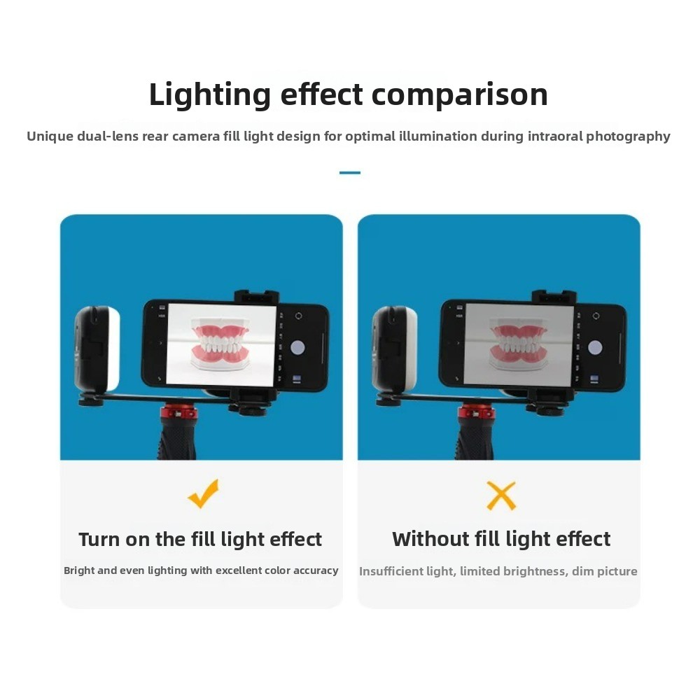 Tandheelkundige fotografielamp - Photography Lighting Flash recensie en prijs